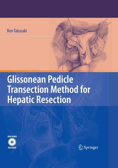 Glissonean Pedicle Transection Method for Hepatic Resection -  Ken Takasaki