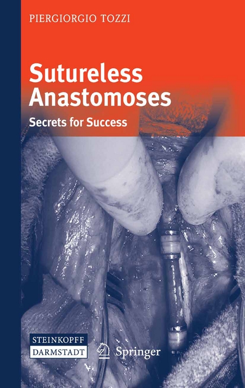 Sutureless Anastomoses - Piergiorgio Tozzi