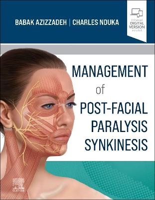 Management of Post-Facial Paralysis Synkinesis - 