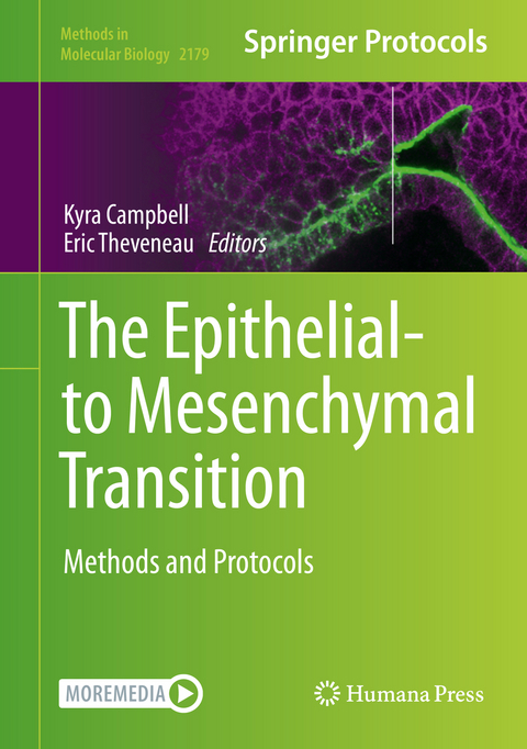 The Epithelial-to Mesenchymal Transition - 