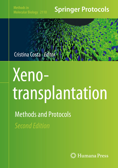 Xenotransplantation - 