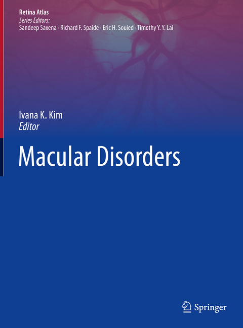 Macular Disorders - 