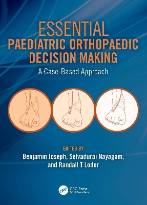 Essential Paediatric Orthopaedic Decision Making - 