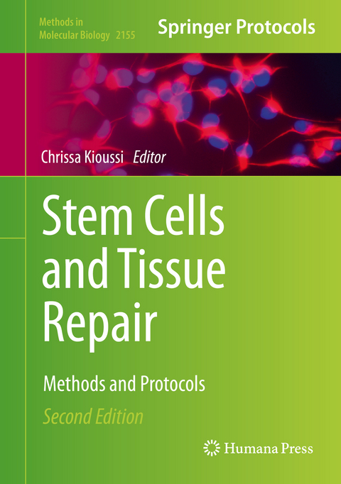 Stem Cells and Tissue Repair - 