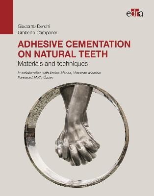 Adhesive cementation on natural teeth - Materials and techniques - Giacomo Derchi, Umberto Campaner