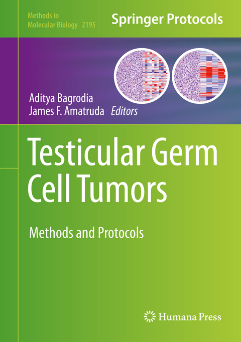 Testicular Germ Cell Tumors - 