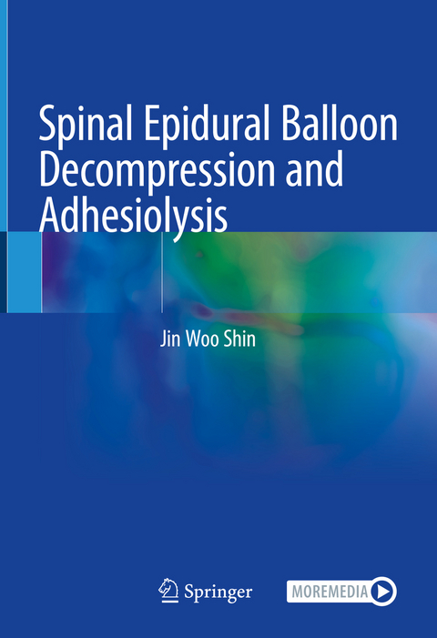 Spinal Epidural Balloon Decompression and Adhesiolysis - Jin Woo Shin