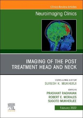 Imaging of the Post Treatment Head and Neck, An Issue of Neuroimaging Clinics of North America - 