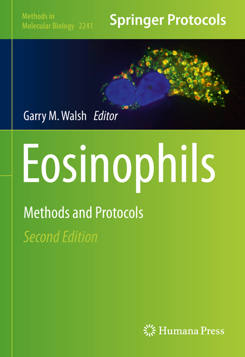 Eosinophils - 