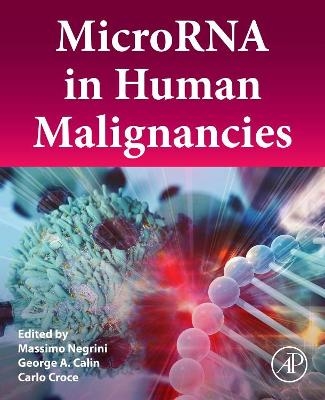 MicroRNA in Human Malignancies - 