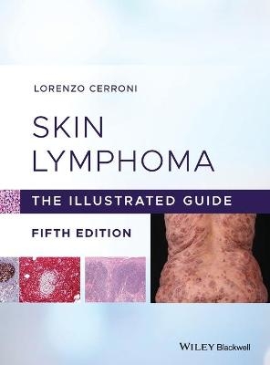 Skin Lymphoma - Lorenzo Cerroni