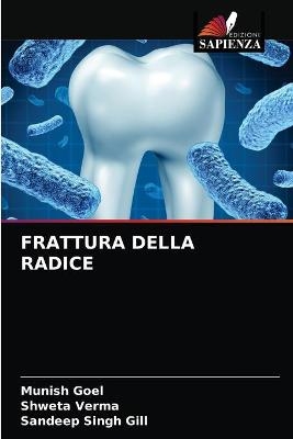 Frattura Della Radice - Munish Goel, Shweta Verma, Sandeep Singh Gill