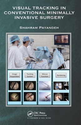 Visual Tracking in Conventional Minimally Invasive Surgery - Shahram Payandeh