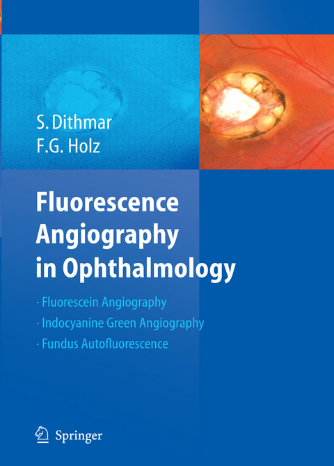 Fluorescence Angiography in Ophthalmology - Stefan Dithmar, Frank G. Holz