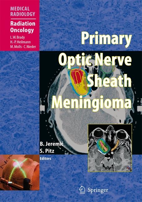 Primary Optic Nerve Sheath Meningioma - 