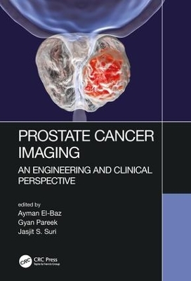 Prostate Cancer Imaging - 