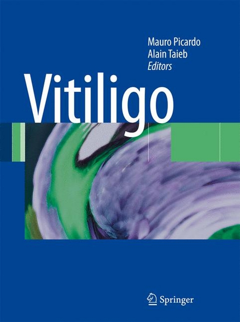 Vitiligo - 