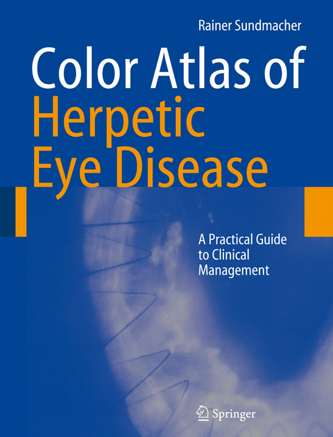 Color Atlas of Herpetic Eye Disease - Rainer Sundmacher