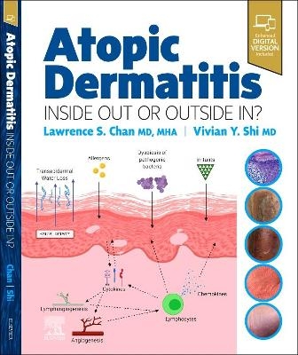 Atopic Dermatitis: Inside Out or Outside In - 