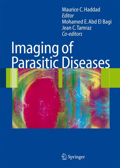 Imaging of Parasitic Diseases - 