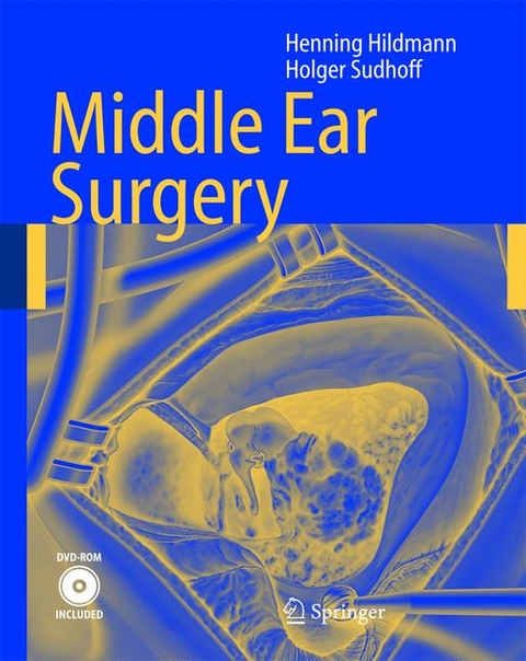 Middle Ear Surgery - Henning Hildmann, Holger Sudhoff