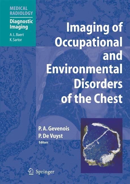 Imaging of Occupational and Environmental Disorders of the Chest - 