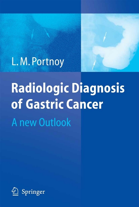 Radiologic Diagnosis of Gastric Cancer - L.M. Portnoy