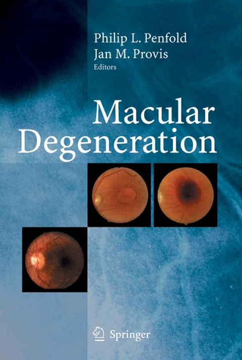 Macular Degeneration - 