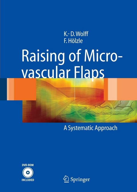 Raising of Microvascular Flaps - Klaus-Dietrich Wolff, Frank Hölzle