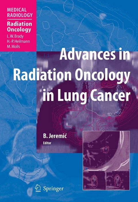 Advances in Radiation Oncology in Lung Cancer - 