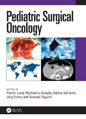 Pediatric Surgical Oncology - Paul D. Losty, Michael La Quaglia, Sabine Sarnacki, Joerg Fuchs, Tomoaki Taguchi