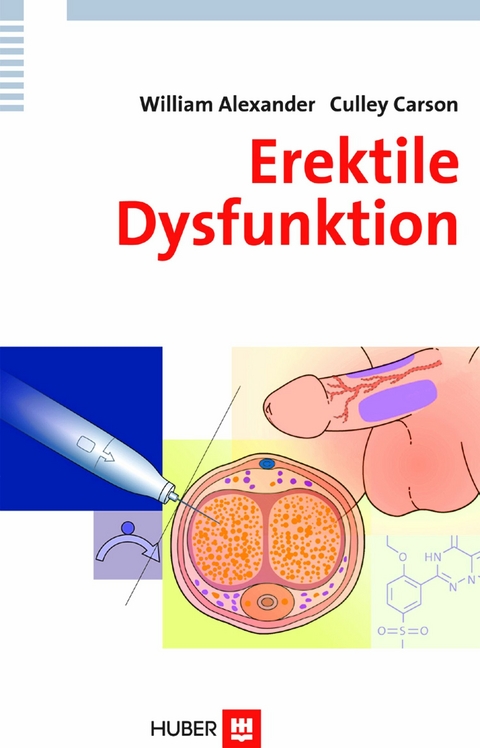 Erektile Dysfunktion - William Alexander, Culley Carson