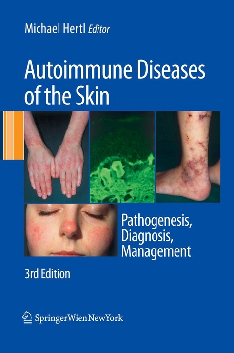 Autoimmune Diseases of the Skin - 