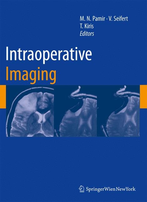 Intraoperative Imaging - 