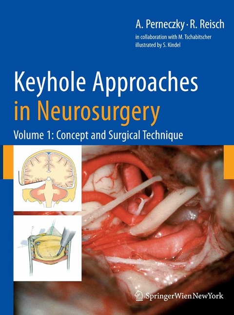 Keyhole Approaches in Neurosurgery - Axel Perneczky, Robert Reisch