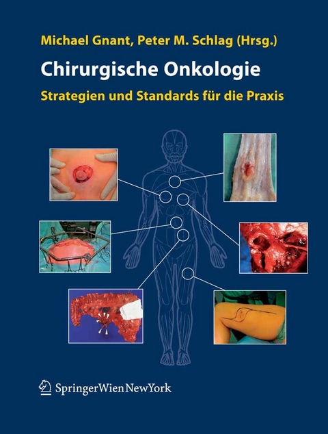 Chirurgische Onkologie - 