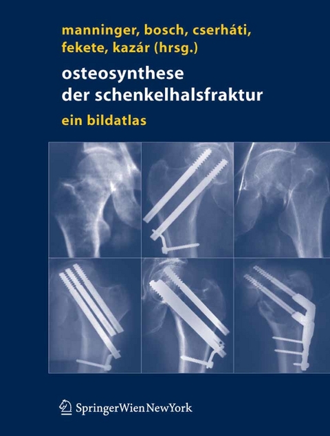 Osteosynthese der Schenkelhalsfraktur - 