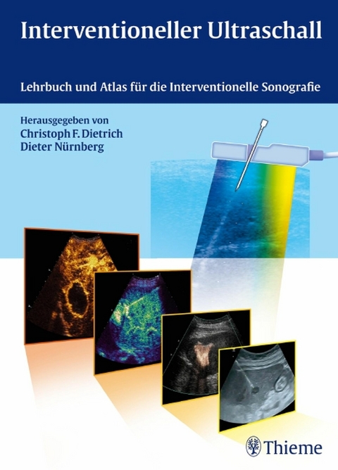 Interventioneller Ultraschall -  Christoph Frank Dietrich,  Dieter Nürnberg