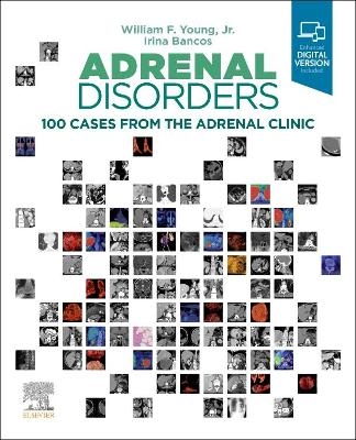 Adrenal Disorders - William F. Young, Irina Bancos