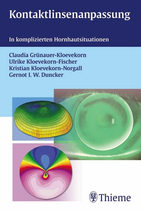 Kontaktlinsenanpassung -  Claudia Grünauer-Kloevekorn,  Ulrike Kloevekorn-Fischer,  Kristian Kloevekorn-Norgall,  Gernot I. W. Du