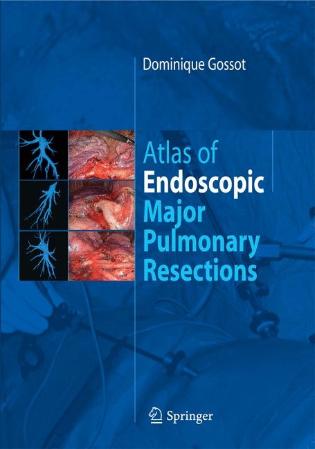 Atlas of endoscopic major pulmonary resections -  Dominique Gossot