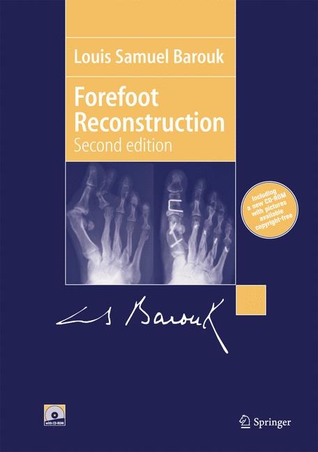 Forefoot Reconstruction - Louis-Samuel Barouk