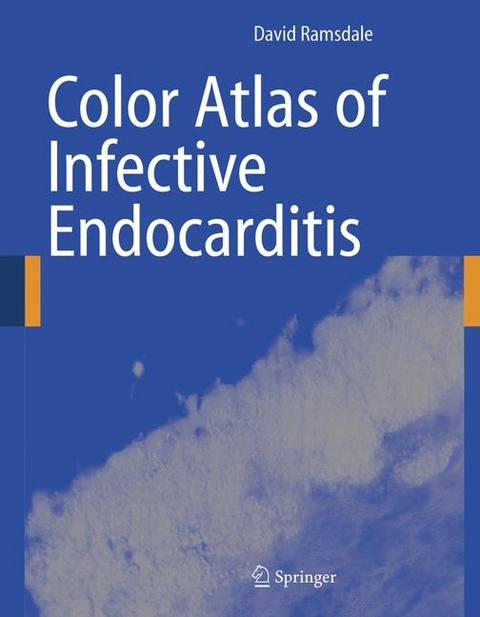 Color Atlas of Infective Endocarditis -  David R. Ramsdale