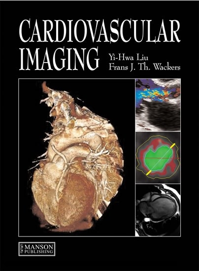 Cardiovascular Imaging - New Haven Yi-Hwa (Yale University School of Medicine  Connecticut  USA) Liu, New Haven Frans (Yale University School of Medicine  Connecticut  USA) Wackers