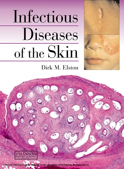 Infectious Diseases of the Skin -  Dirk Elston