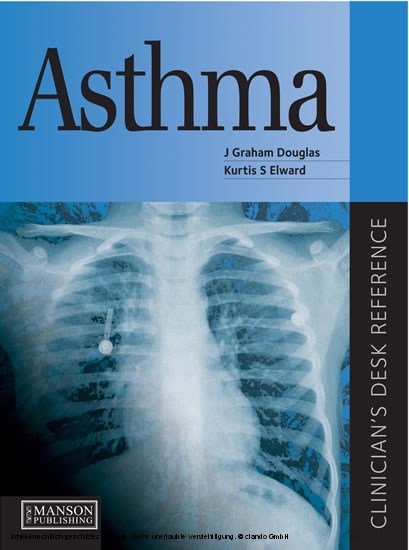 Asthma -  J Douglas,  Kurtis Elward