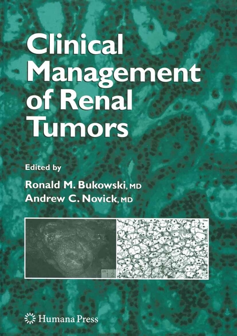 Clinical Management of Renal Tumors - 