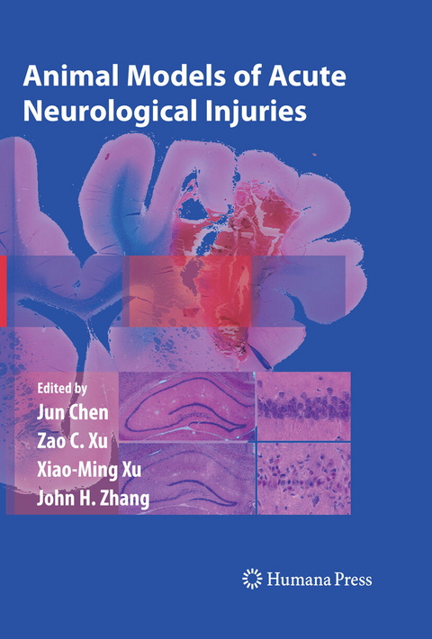 Animal Models of Acute Neurological Injuries - 