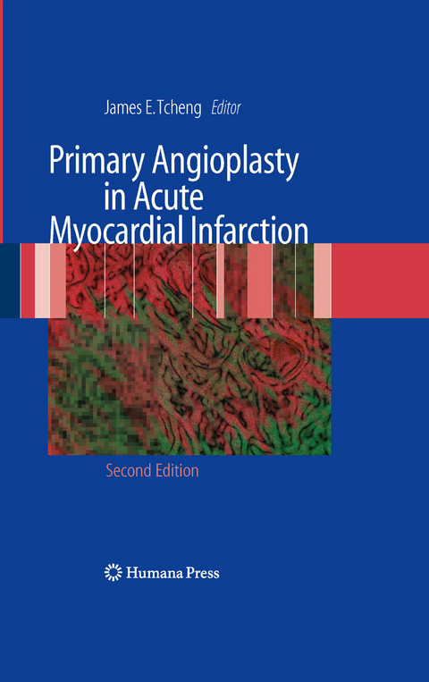 Primary Angioplasty in Acute Myocardial Infarction - 