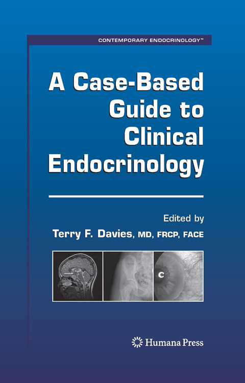 A Case-Based Guide to Clinical Endocrinology - 